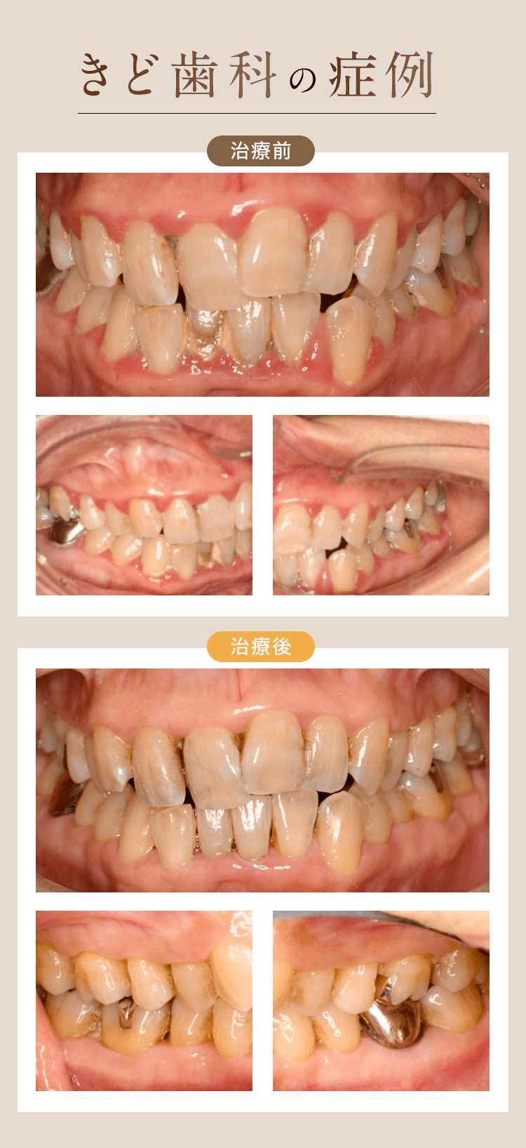 きど歯科の症例