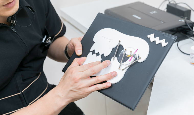 顎関節症治療について